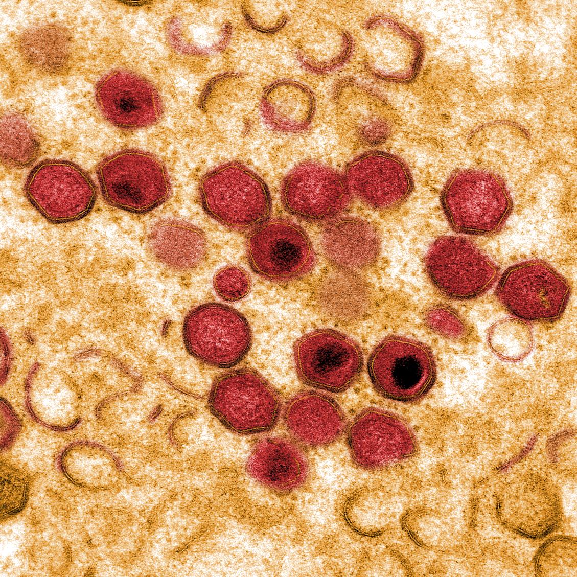 New Research Reveals African Swine Fever Virus Has Circulated in Europe Since 2007